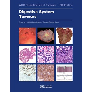 WHO Classification of Tumours. Digestive System Tumours: WHO Classification of Tumours, Volume 1 (World Health Organization classification of tumours)
