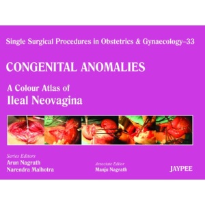 Single Surgical Procedures in Obstetrics and Gynaecology: Vaginoplasty - A Colour Atlas of Ileal Neovagina Volume 33