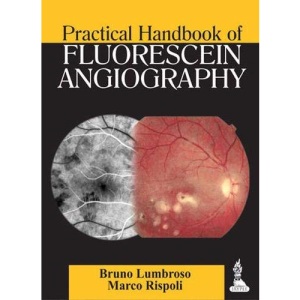 Practical Handbook of Fluorescein Angiography