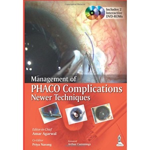 Management of Phaco Complications: Newer Techniques