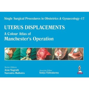 Single Surgical Procedures in Obstetrics and Gynaecology - 17 - Uterus Displacements: A Colour Atlas of Manchester's Operation