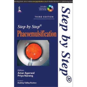 Step by Step Phacoemulsification