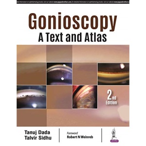 Gonioscopy: A Text and Atlas