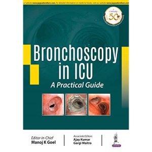 Bronchoscopy in ICU: A Practical Guide