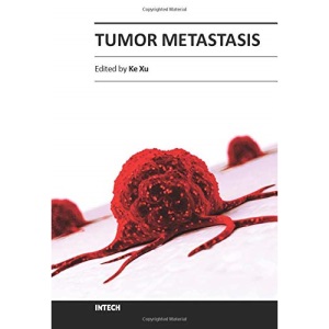 Tumor Metastasis
